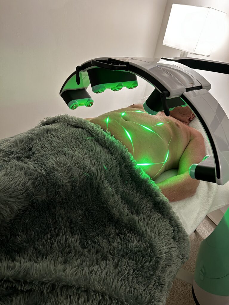 laserbehandeling man